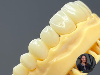 Case Author: Júlio Natali From Brazil Material: Multilayer PMMA  Color code: B1