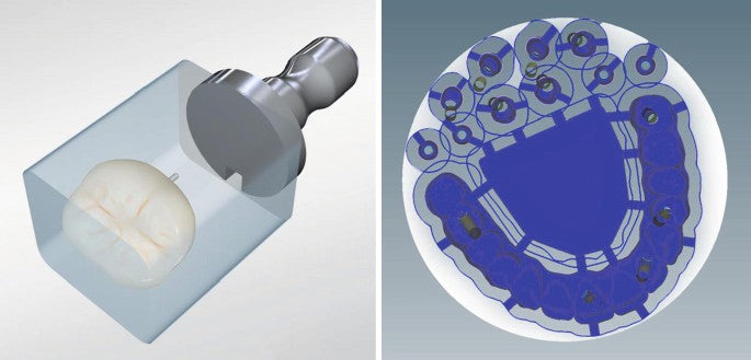 Material Uses for CAD/CAM Process in Dentistry