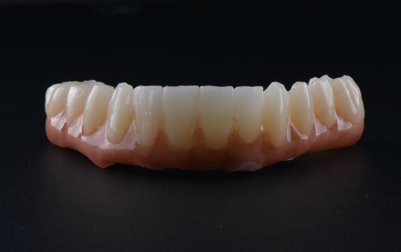 Why do dentists always recommend zirconia porcelain teeth? Is it really that good?