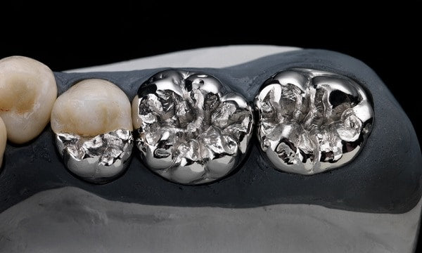 Advantages of cobalt chromium alloy in dental applications