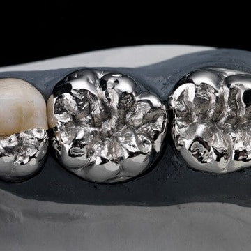 Advantages of cobalt chromium alloy in dental applications