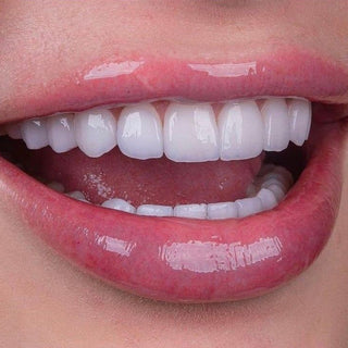 Comparison of glass ceramics and zirconia in anterior restorations.