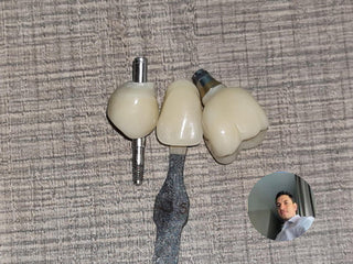 2024-08-31 case:    From Chile     Author: Andre      Material: ST+Multilayer