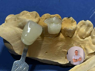 2024-12-20 case:   From:Chile   Author:samith  Material:Lithium disilicate ingot