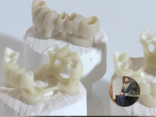 2025-01-02 case:   From:Mexico   Author:Guillermo  Material:Lithium disilicate ingot