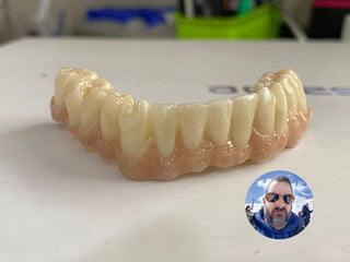 2024-11-30 case:   From:Mexico   Author:Jorge  Material:ST+Color zirconia