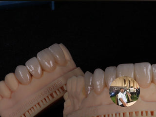 2024-11-20 case:   From:Brazilian   Author:Mauricio    Material:Lithium disilicate