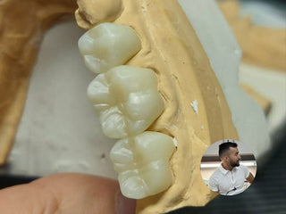 2024-09-13 case:    From：Mexico     Author:Pedro    Material:3D Pro Multilayer
