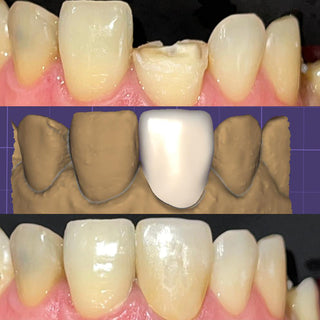 3D Pro Multilayer Zirconia Block AG System 71mm