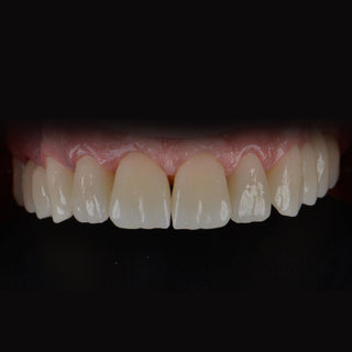 ST+Color Sistema AG de Bloco de Zircônia Pré-colorida 71mm 