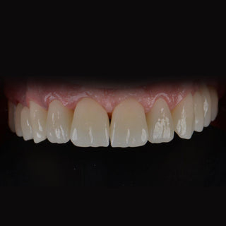 ST+Color Precolored Zirconia Block AG System  71mm