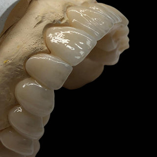 Sistema de blocos de zircônia multicamadas UTEx Pro Sirona 