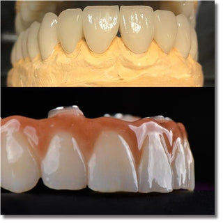 Sistema de blocos de zircônia multicamadas UTEx Pro Sirona 