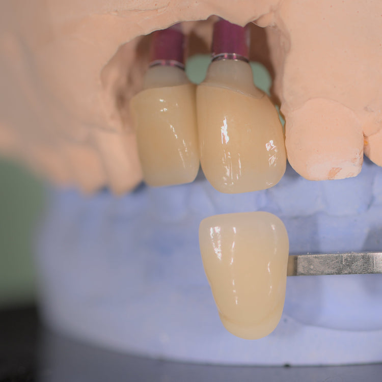 zirconia dental implants