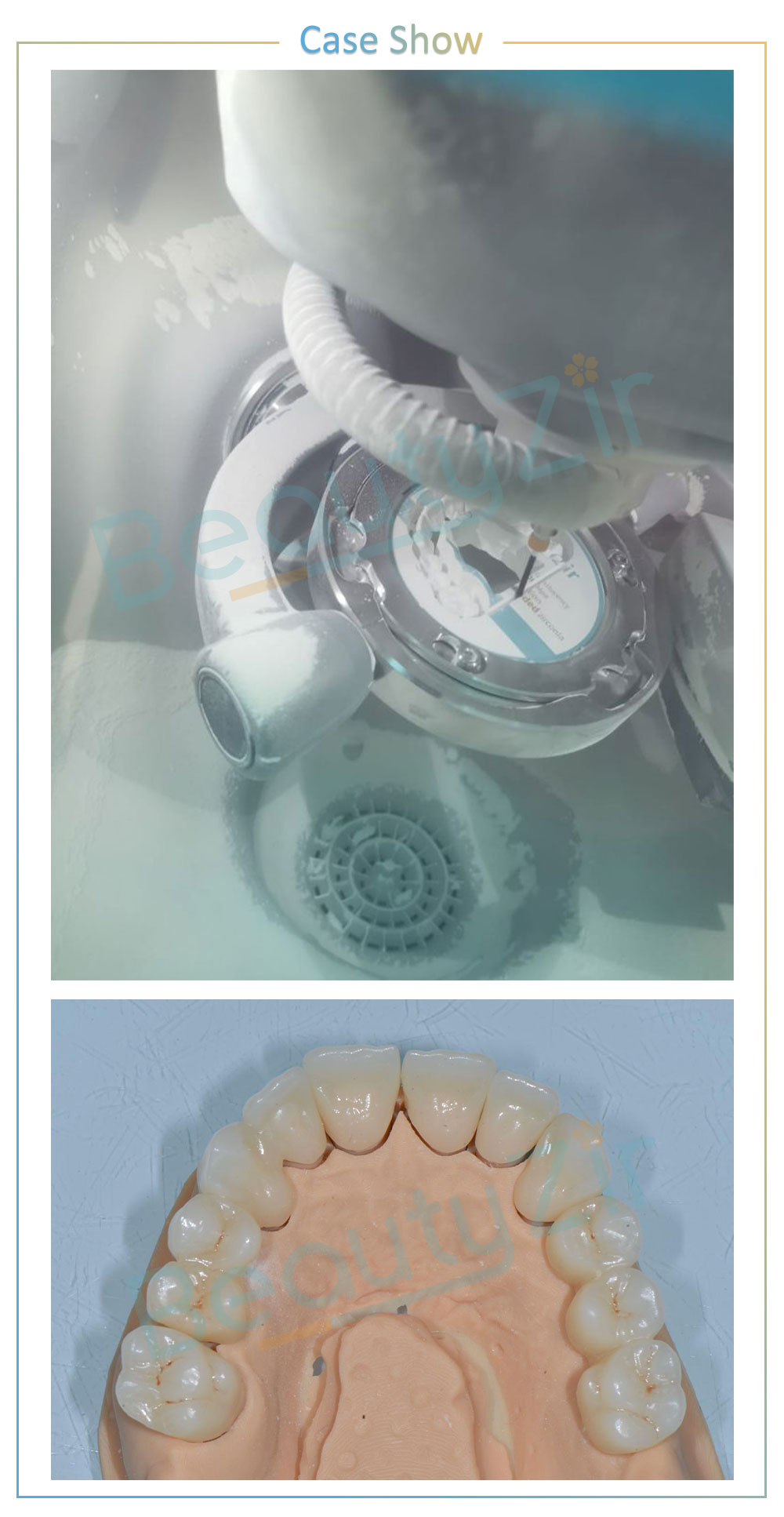 Precolored  Zirconia Disc Open System (98mm)-ST+Color