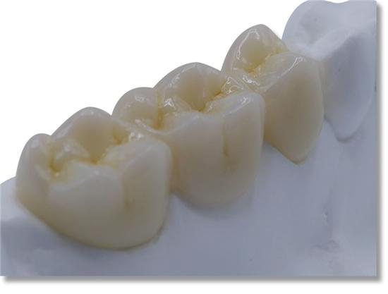 White Zirconia Block Sirona System (5 pieces)-ST+