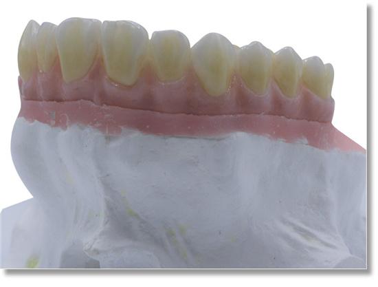 White Zirconia Block Sirona System (5 pieces)-ST+