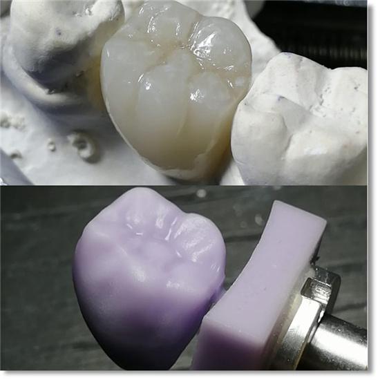 Blocos de dissilicato de lítio (vidro cerâmico)-C14/B40-HT/LT (10 peças)