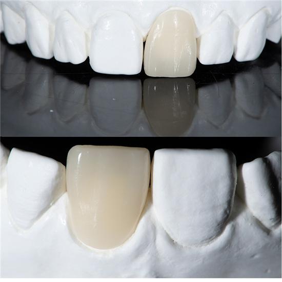 Blocos de dissilicato de lítio (vidro cerâmico)-C14/B40-HT/LT (10 peças)