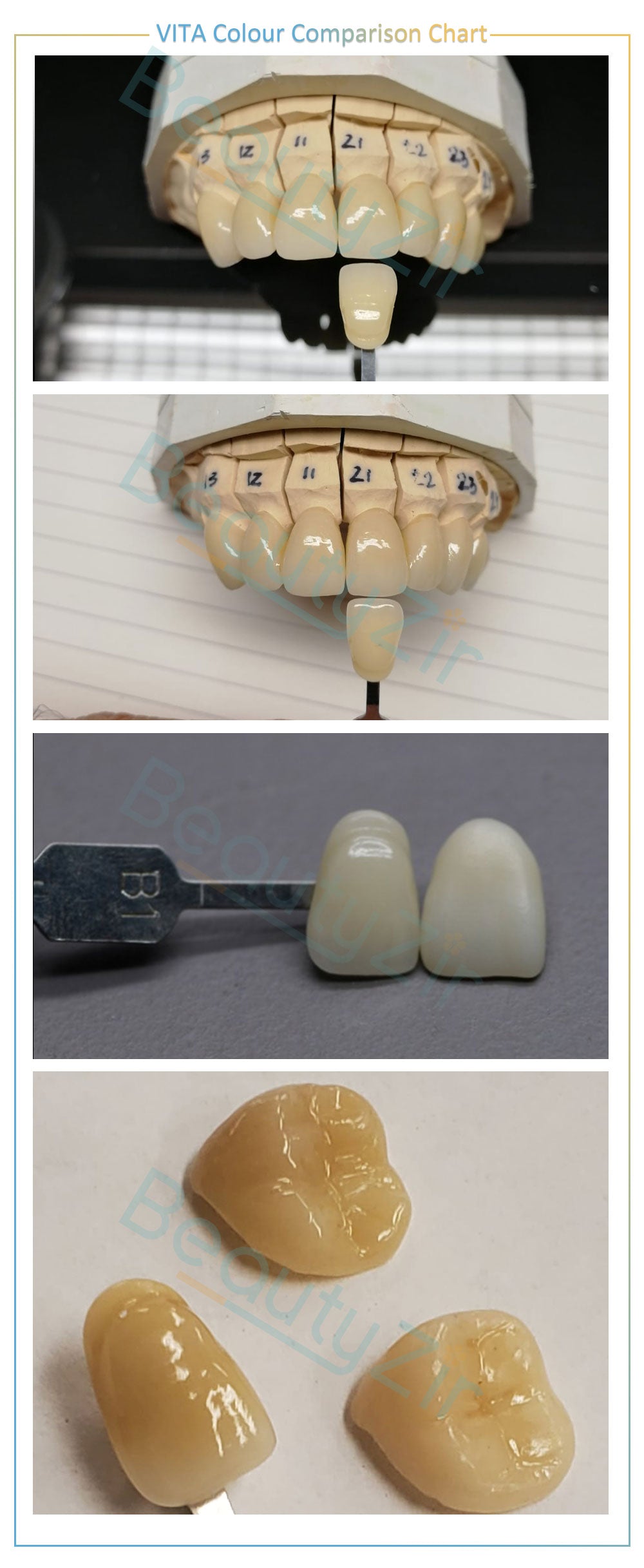 UTEx Pro-Multilayer Zirconia Block Sirona System