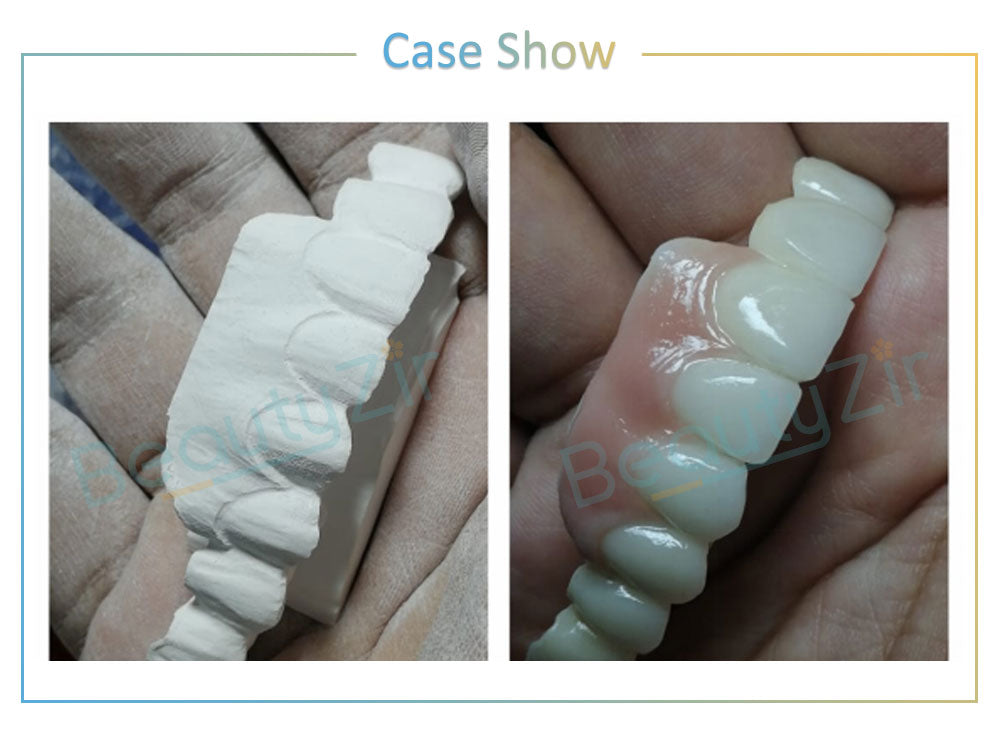 White Zirconia Disc For Zirkonzahn System (95mm)-HT
