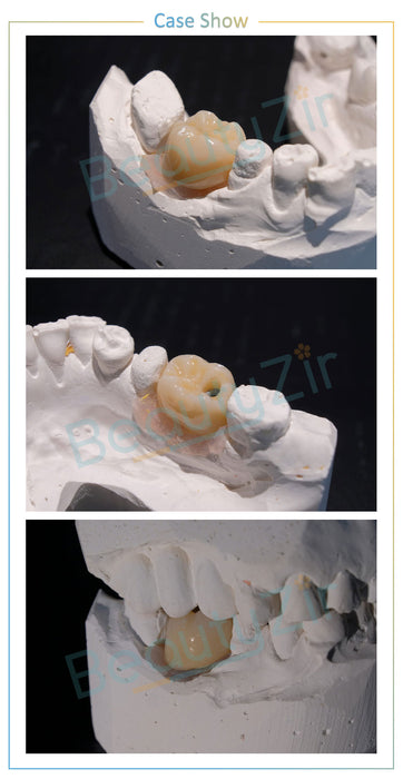 White Zirconia Block Sirona System (5 pieces)-ST+