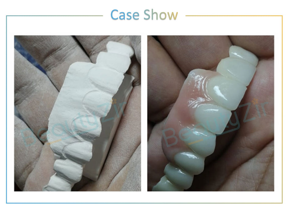 Bloques de Zirconia Blanca para Sirona System Dental-HT(5 piezas)